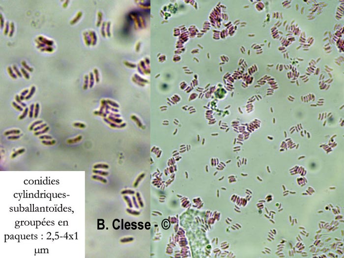 Ascocoryne albida